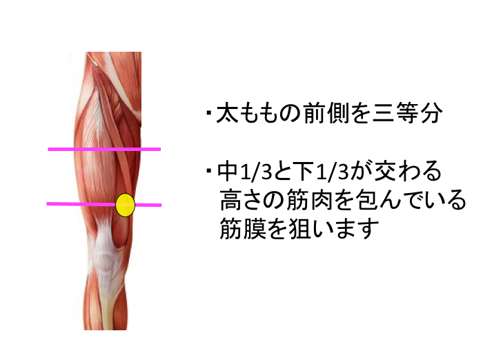 ジャンプ ターン ステップの膝痛の原因と解決するために必要な筋膜調整とは 筋膜調整サロン トリガー Trigger