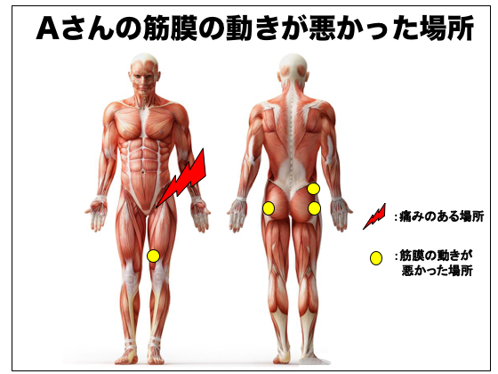 平泳ぎで股関節の内側が痛い時の原因と対処方法とは 筋膜調整サロン トリガー Trigger